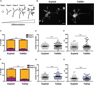 Neuronal Cell-Intrinsic Defects in Mouse Models of Down Syndrome